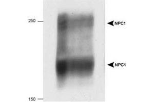 Western blot analysis of NPC1 in 20 ug of human fibroblast cell lysate with NPC1 polyclonal antibody . (NPC1 抗体  (AA 1230-1278))