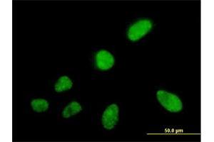 Immunofluorescence of purified MaxPab antibody to SFRS5 on HeLa cell.