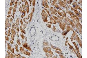 Image no. 1 for anti-NADH Dehydrogenase (Ubiquinone) 1 alpha Subcomplex, 8, 19kDa (NDUFA8) (AA 1-73) antibody (ABIN599409) (NDUFA8 抗体  (AA 1-73))