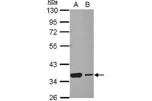 WB Image Sample (30 ug of whole cell lysate) A: NT2D1 B: SK-N-SH 10% SDS PAGE antibody diluted at 1:1000 (HSF2BP 抗体)