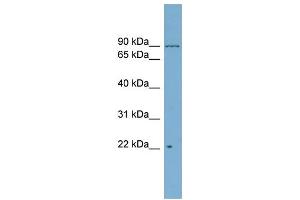 WB Suggested Anti-C12orf11  Antibody Titration: 0. (C12orf11 抗体  (Middle Region))