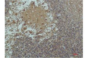 Immunohistochemical (IHC) analysis of paraffin-embedded Human Brain Tissue using a-tubulin(Acetyl Lys40) Mouse Monoclonal Antibody diluted at 1:200. (alpha Tubulin 抗体  (acLys40))