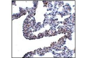 Immunohistochemistry of PCDH12 in rat lung tissue with this product at 5 μg/ml. (PCDH12 抗体  (N-Term))