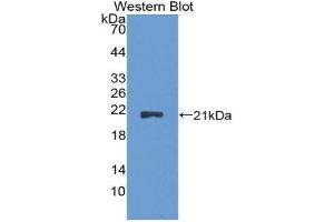Detection of Recombinant CDKN2A, Rat using Polyclonal Antibody to Cyclin Dependent Kinase Inhibitor 2A (CDKN2A) (CDKN2A 抗体  (AA 3-155))