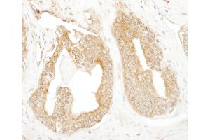 Immunohistochemistry (IHC) image for anti-Ubiquitin Protein Ligase E3 Component N-Recognin 4 (UBR4) (AA 5133-5183) antibody (ABIN7448995)