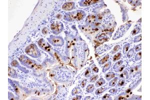 IHC analysis of MUC2 using anti-MUC2 antibody . (MUC2 抗体)