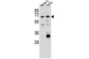 CES8 Antibody (C-term) western blot analysis in Sk-Br-3,T47D cell line lysates (35µg/lane).