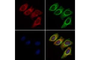 ABIN6261371 and ABIN6277296 staining Hela cells by IF/ICC. (Dynamin 1-Like 抗体  (C-Term))