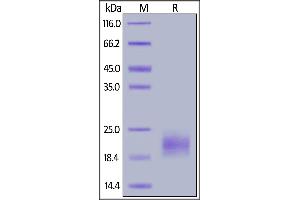 Human IL-5, His Tag on  under reducing (R) condition. (IL-5 Protein (AA 20-134) (His tag))