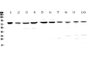 Western blot analysis of PARN using anti-PARN antibody . (PARN 抗体  (AA 1-301))
