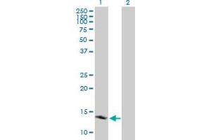 Western Blotting (WB) image for anti-Peripheral-Type Benzodiazepine Receptor (TSPO) (AA 1-169) antibody (ABIN513840)
