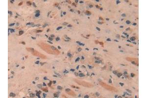 Immunohistochemistry (IHC) image for anti-Sprouty Homolog 1, Antagonist of FGF Signaling (SPRY1) (AA 118-309) antibody (ABIN1860620)