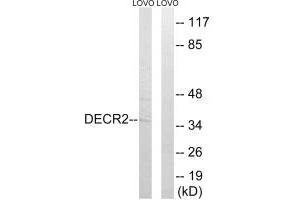 Western blot analysis of extracts from LOVO cells, using DECR2 antibody. (DECR2 抗体)