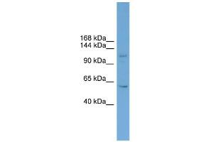 WB Suggested Anti-ZNF628 Antibody Titration:  0. (ZNF628 抗体  (Middle Region))
