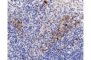 Immunohistochemistry analysis of paraffin-embedded human tonsil using CASP1 Polyclonal Antibody at dilution of 1:300. (Caspase 1 抗体)