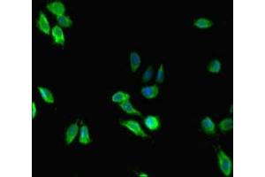 Immunofluorescent analysis of Hela cells using ABIN7159407 at dilution of 1: 100 and Alexa Fluor 488-congugated AffiniPure Goat Anti-Rabbit IgG(H+L) (Menin 抗体  (AA 1-615))