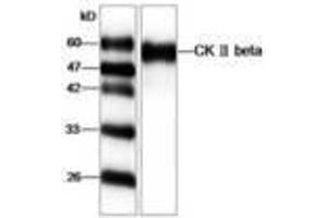 Image no. 1 for anti-Casein Kinase 2, beta (CSNK2B) antibody (ABIN791461) (CSNK2B 抗体)