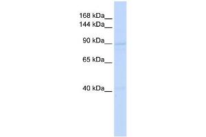 WB Suggested Anti-RAD54B Antibody Titration:  0. (RAD54B 抗体  (Middle Region))