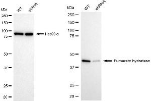 Western blotting analysis using fumarate hydratase antibody (ABIN7798664). (FH 抗体)