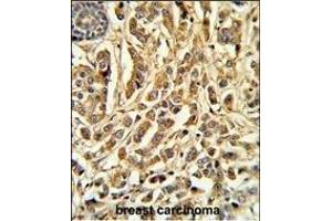 Immunohistochemistry (Paraffin-embedded Sections) (IHC (p)) image for anti-Cytochrome P450, Family 21, Subfamily A, Polypeptide 2 (CYP21A2) (AA 216-246) antibody (ABIN652409)