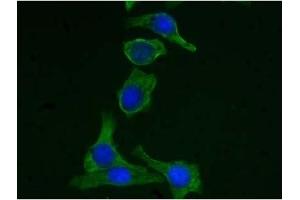 Immunofluorescence (IF) image for anti-Keratin 19 (KRT19) (C-Term) antibody (ABIN371616)