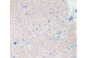 Used in DAB staining on fromalin fixed paraffin- embedded Kidney tissue (Tachykinin 3 抗体  (AA 29-102))