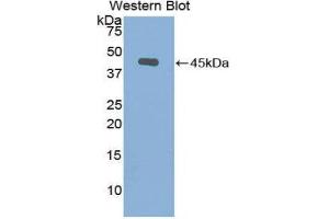 Western Blotting (WB) image for anti-Gelsolin (GSN) (AA 432-553) antibody (ABIN1078060) (Gelsolin 抗体  (AA 432-553))