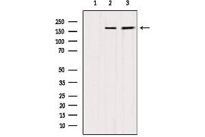 Western blot analysis of extracts from various samples, using MYOM2 Antibody. (MYOM2 抗体  (Internal Region))