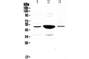 Western blot analysis of PAI1 using anti-PAI1 antibody . (PAI1 抗体  (AA 24-240))