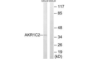 Western Blotting (WB) image for anti-Aldo-keto Reductase Family 1, Member C2 (AKR1C2) (Internal Region) antibody (ABIN1850720)
