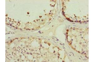 Immunohistochemistry of paraffin-embedded human testis tissue using ABIN7159918 at dilution of 1:100 (TOMM34 抗体  (AA 1-309))