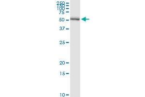 Immunoprecipitation (IP) image for anti-Proteasome (Prosome, Macropain) 26S Subunit, Non-ATPase, 5 (PSMD5) (AA 1-504) antibody (ABIN950150)