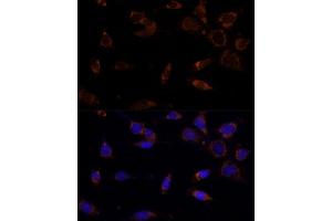 Immunofluorescence analysis of NIH-3T3 cells using MTCH2 Polyclonal Antibody  at dilution of 1:100 (40x lens). (MTCH2 抗体  (AA 30-175))