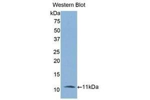 Western Blotting (WB) image for anti-Interleukin 6 Receptor (IL6R) (AA 19-108) antibody (ABIN3206013) (IL-6 Receptor 抗体  (AA 19-108))