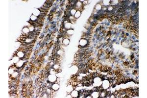 IHC testing of FFPE rat intestine with HLA-C antibody. (HLA-C 抗体)