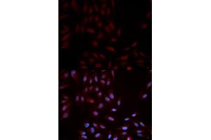 Immunofluorescence analysis of U2OS cells using Phospho-MAPK14-Y322 antibody (ABIN5969909). (MAPK14 抗体  (pTyr322))