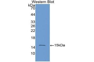 Western blot analysis of the recombinant protein. (HRAS 抗体  (AA 82-176))