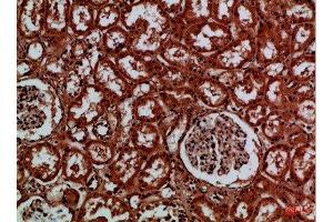 Immunohistochemical analysis of paraffin-embedded Human-kidney, antibody was diluted at 1:100 (EYA1 抗体)