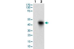 Western blot analysis of Lane 1: Negative control [HEK293 cell lysate]; Lane 2: Over-expression lysate [ROR2 (AA: 59-155)-hIgGFc transfected HEK293 cells] with ROR2 monoclonal antibody, clone 6F2D10  at 1:500-1:2000 dilution. (ROR2 抗体  (AA 59-155))