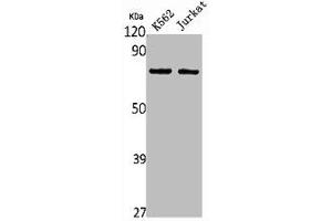 Western Blot analysis of K562 Jurkat cells using HGFA Polyclonal Antibody (HGFA 抗体  (C-Term))