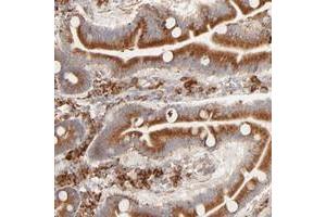 Immunohistochemical staining of human duodenum with PARP12 polyclonal antibody  shows strong cytoplasmic positivity in glandular cells. (PARP12 抗体)