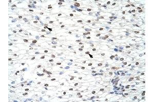 CUGBP2 antibody was used for immunohistochemistry at a concentration of 4-8 ug/ml to stain Myocardial cells (arrows) in Human Heart. (CELF2 抗体  (N-Term))