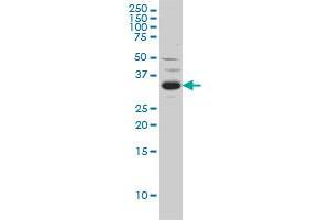 Western Blotting (WB) image for anti-Sprouty Homolog 2 (SPRY2) (AA 1-316) antibody (ABIN599124) (SPRY2 抗体  (AA 1-316))