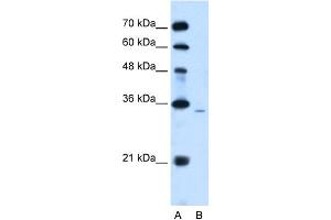 Western Blotting (WB) image for anti-Phosphatidic Acid Phosphatase Type 2A (PPAP2A) (Middle Region) antibody (ABIN2777163)