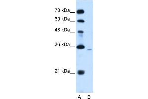 WB Suggested Anti-PPAP2A Antibody Titration:  2. (PPAP2A 抗体  (Middle Region))