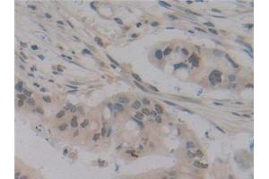 Immunohistochemistry (IHC) image for anti-Cylindromatosis (Turban Tumor Syndrome) (CYLD) (AA 170-338) antibody (ABIN7434896)