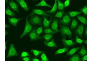 Immunofluorescence analysis of A549 cells using XRCC2 antibody. (XRCC2 抗体)