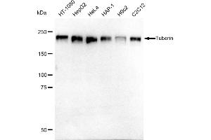 Western blotting analysis using Tuberin antibody (ABIN7800657). (Recombinant Tuberin 抗体)