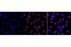Immunocytochemical staining of C2C12 cells with DNA polymerase beta antibody (ABIN7799875), 1:1,000). (Recombinant POLB 抗体)