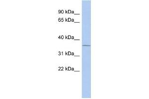 WB Suggested Anti-UPP1 Antibody Titration:  0. (UPP1 抗体  (Middle Region))